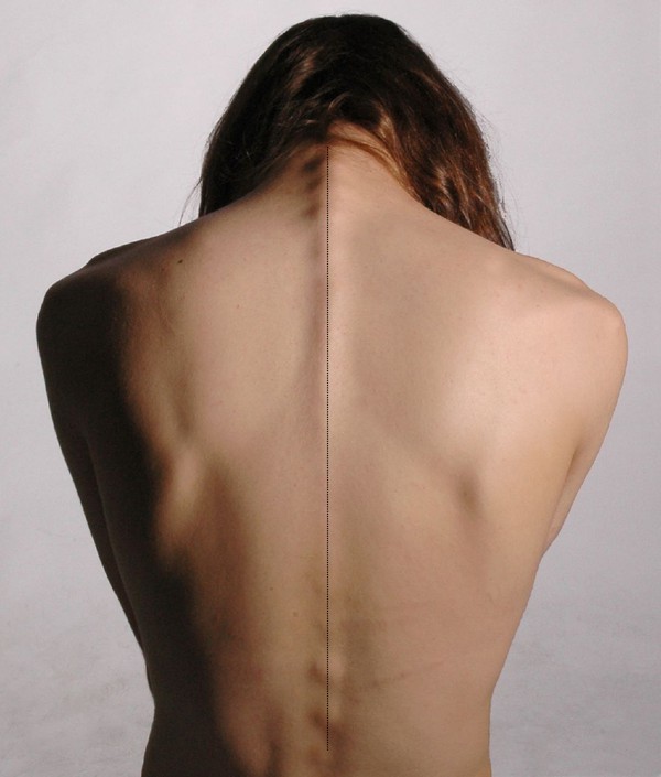 2 vị tr&iacute; nếu kh&ocirc;ng biết c&aacute;ch massage sẽ g&acirc;y tử vong ngay - Ảnh 2.