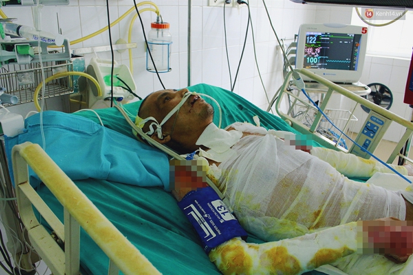 X&uacute;c động chuyện ch&agrave;ng trai 20 tuổi vất vả l&agrave;m c&ocirc;ng nh&acirc;n nu&ocirc;i 3 người th&acirc;n bị bỏng nặng - Ảnh 4.