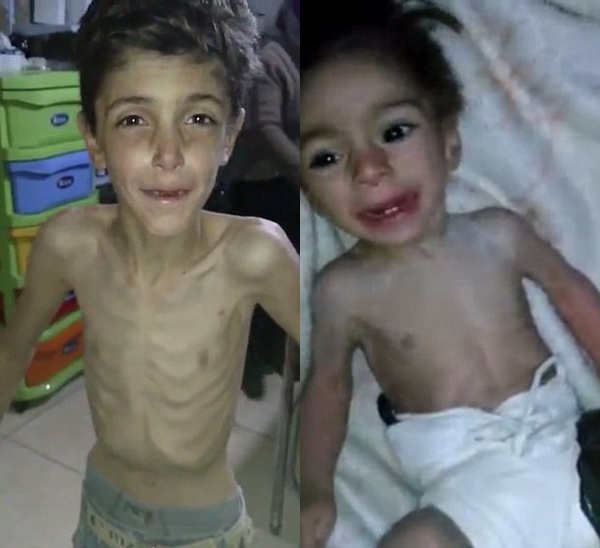 Cả thế giới bàng hoàng trước đoạn clip cho thấy nạn đói kinh hoàng ở Syria - Ảnh 2.