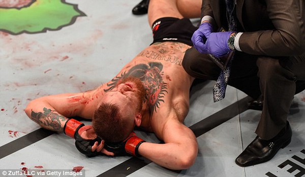 Mặt đầm đìa máu, Nate Diaz vẫn hạ knock-out gã điên McGregor - Ảnh 6.
