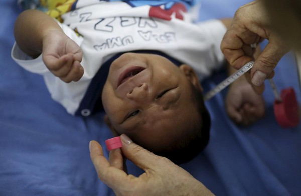 Chùm ảnh: Gương mặt đáng thương của những đứa trẻ bị nhiễm virus gây teo não Zika - Ảnh 8.