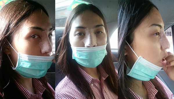 Đọc b&agrave;i n&agrave;y xong, bạn sẽ thấy niềng răng ch&iacute;nh l&agrave; phương ph&aacute;p l&agrave;m đẹp hiệu quả nhất! - Ảnh 10.