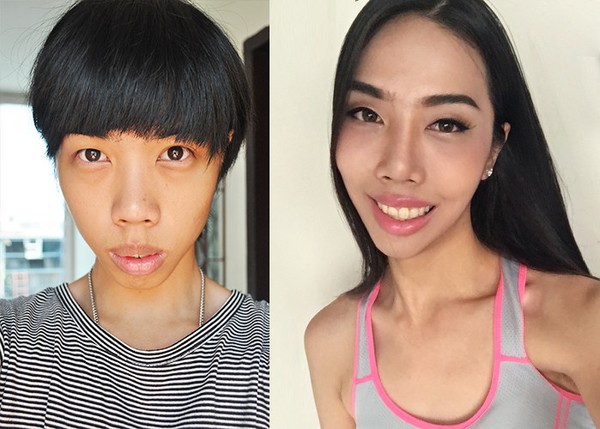 Đọc b&agrave;i n&agrave;y xong, bạn sẽ thấy niềng răng ch&iacute;nh l&agrave; phương ph&aacute;p l&agrave;m đẹp hiệu quả nhất! - Ảnh 1.