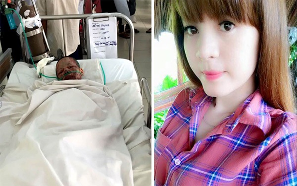 Cô Gái Xinh Đẹp Bị Người Yêu Tạt Xăng Đốt Đã Qua Đời Sau 1 Tháng Điều Trị