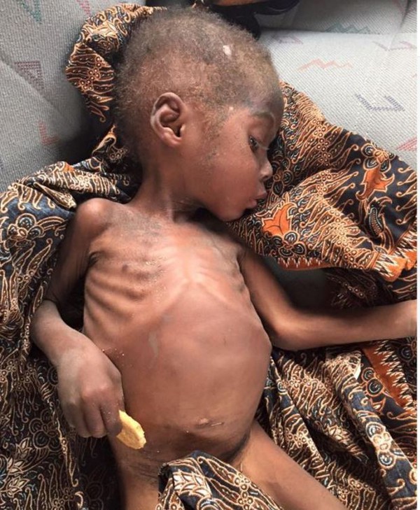 Bức ảnh đau lòng về cậu bé bị bỏ đói đến suýt chết trên đường phố Nigeria - Ảnh 5.