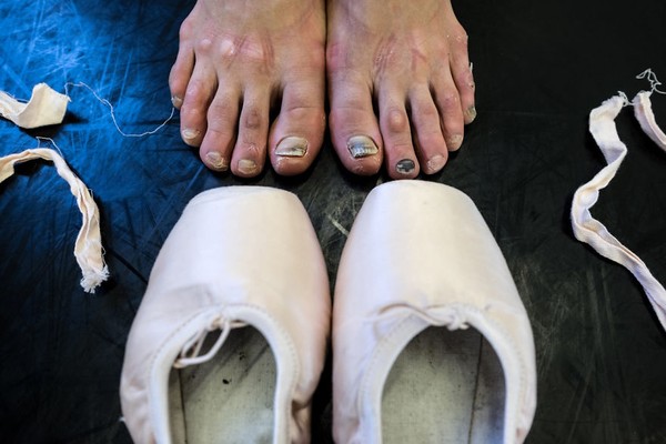 Chùm ảnh: Đôi chân rướm máu của những thiên thần múa ballet - Ảnh 13.