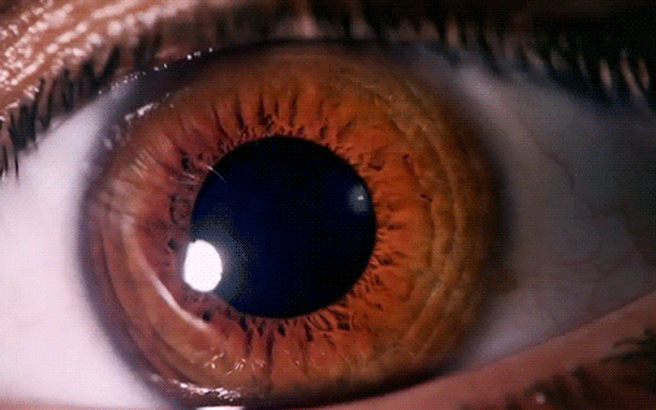 Mắt màu nâu thường có mức độ phân tán melanin như thế nào so với mắt có màu khác?
