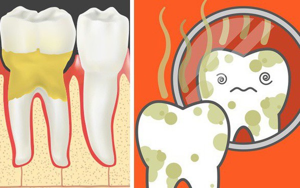 Có phương pháp tự nhiên nào để khử mùi kim loại trong miệng và hơi thở?
