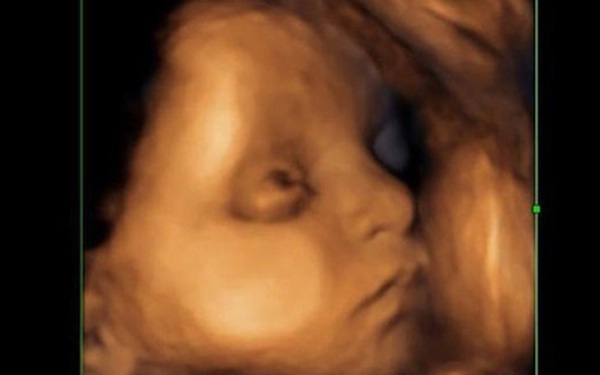 Tại sao em bé trong bụng mẹ nhắm mắt và tránh ánh sáng như chó con mới sinh?
