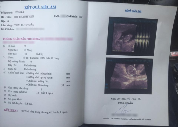 Vợ chồng Phi Thanh Vân đăng ảnh siêu âm, bác bỏ tin đồn mang thai giả