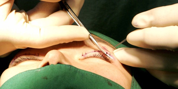 korea-surgery-fbba9