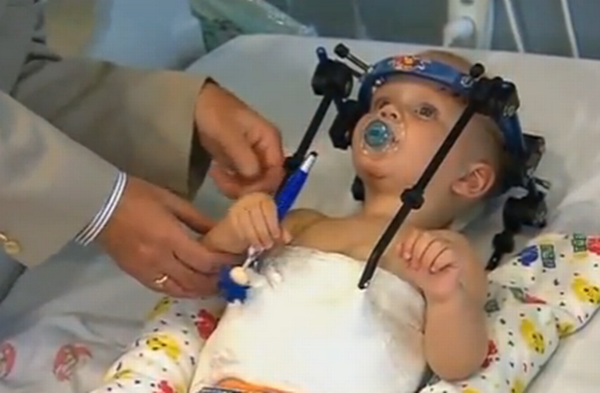 Toddler-Head-Reattached-bdc6a