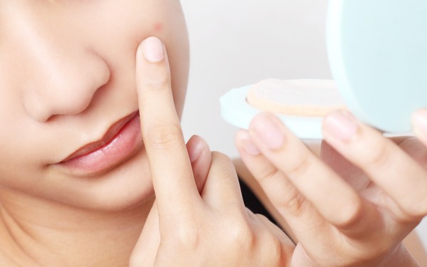 Have-You-an-Acne-or-Pimple-Heres-the-solution-How-To-Get-Rid-Of-Pimples-4d200