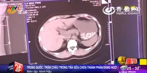 151026bubble02-73d9f