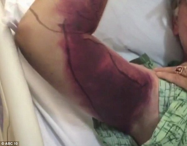 2AC2D8C100000578-0-Fassler_suffered_a_horrific_wound_on_his_arm_after_trying_to_tak-a-20_1437598330518-061bd