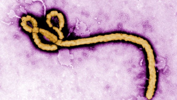 Ebola-virus-pink-jpg-ff543.jpg