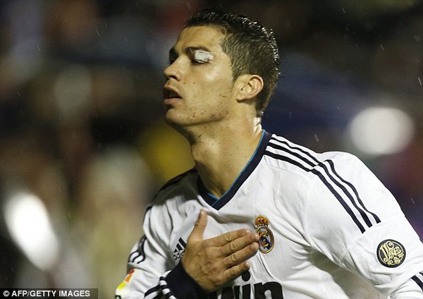 Mắt Ronaldo có vấn đề sau chấn thương kinh hoàng 6