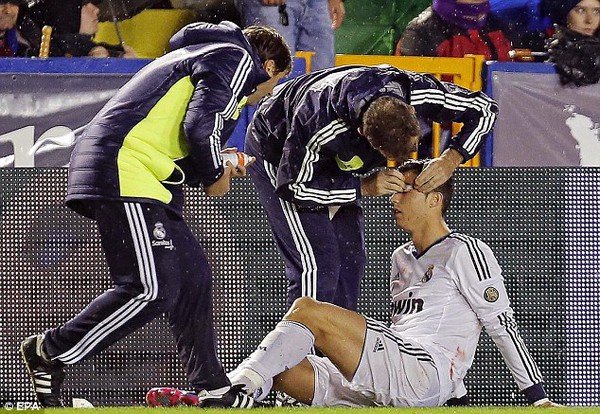 Mắt Ronaldo có vấn đề sau chấn thương kinh hoàng 5