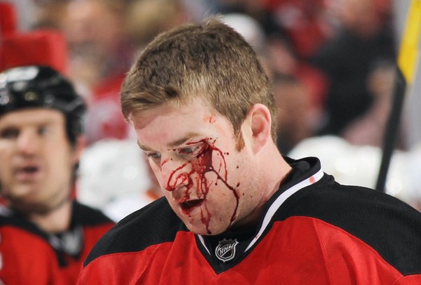 Những chấn thương rợn người trong môn hockey 30