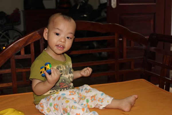 H&agrave; Nội: Kỳ lạ b&eacute; 17 th&aacute;ng tuổi cử động hai tay như một 1