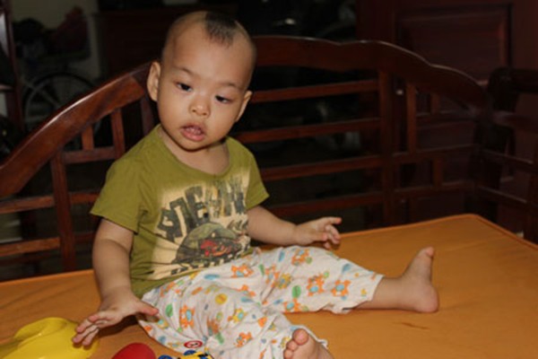 H&agrave; Nội: Kỳ lạ b&eacute; 17 th&aacute;ng tuổi cử động hai tay như một 2