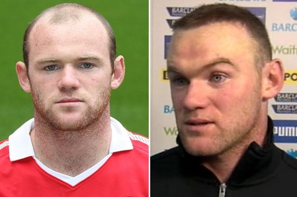 Rooney lại tỉa tót lông mày 1