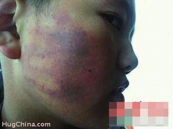 Trung Quốc: Cô giáo bắt 50 học sinh tát vào mặt bạn 1