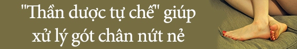 Nâng niu đôi chân bằng công thức "siêu tiết kiệm" 2