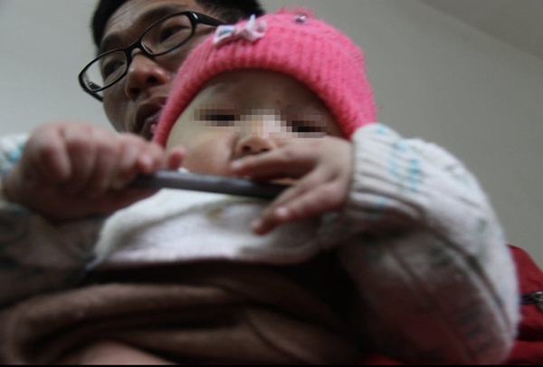 Trung Quốc: Em bé 26 ngón chân tay khác thường 4