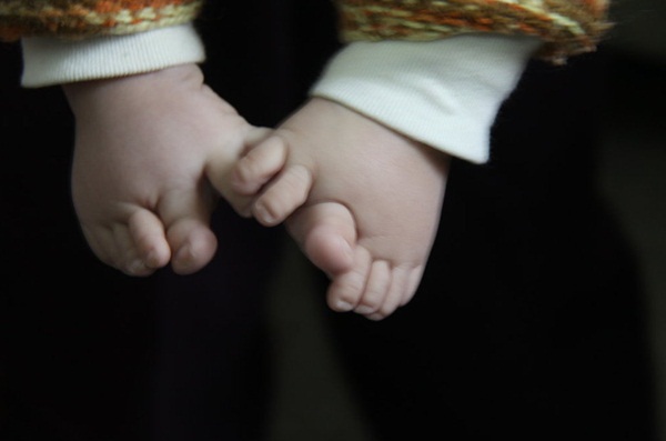 Trung Quốc: Em bé 26 ngón chân tay khác thường 3