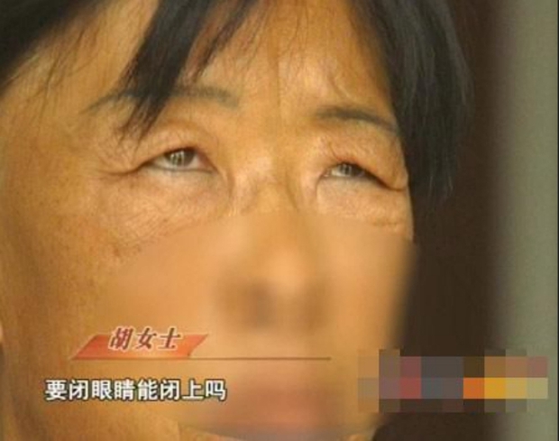 Ham đẹp như gái Hàn, nhiều phụ nữ Trung Quốc ôm hận thiên thu vì phẫu thuật thẩm mỹ hỏng - Ảnh 4.