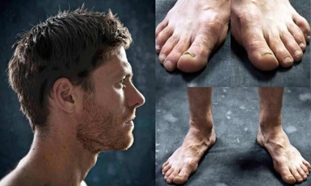 For glory, Ronaldo, Villa... paid the price with these strangely deformed legs - Photo 2.