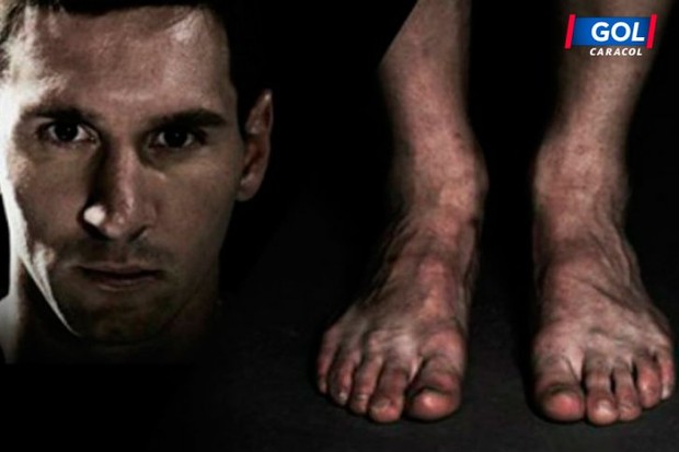 For glory, Ronaldo, Villa... paid the price with these strangely deformed legs - Photo 5.