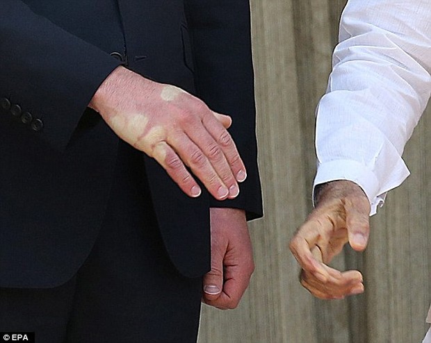 Đây chính là bàn tay của Hoàng tử William sau khi bắt tay với Thủ tướng Ấn Độ - Ảnh 4.