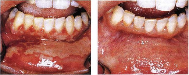 Sẽ ra sao nếu con người hít phải thuỷ ngân? - Ảnh 6.