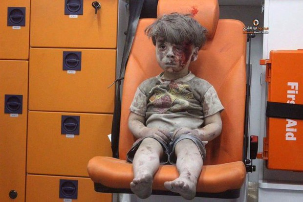 Bức ảnh đau lòng này được chụp sau khi cậu bé Syria hứng chịu một trận không kích - Ảnh 2.