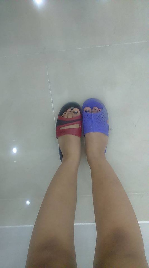 Cư dân mạng đua nhau khoe ảnh đi nhầm dép cọc cạch ra đường chỉ vì trót đánh rơi mất não - Ảnh 3.
