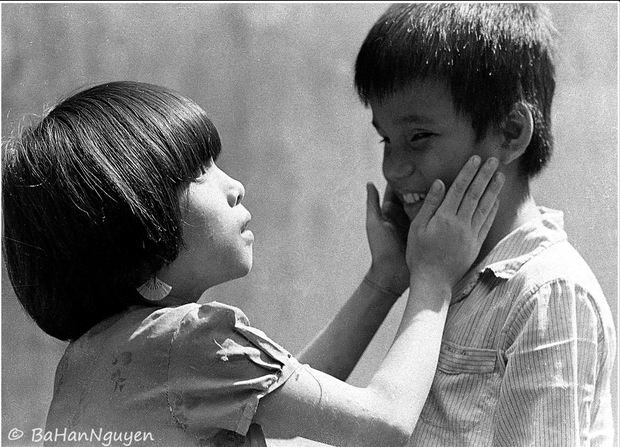 Chuyện của nhiếp ảnh gia 60 tuổi ở Sài Gòn được tái sinh sau 17 ca phẫu thuật vì bỏng lửa - Ảnh 10.