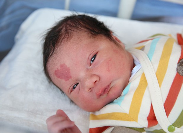 The baby boy looks extremely adorable with a heart-shaped birthmark on his forehead - Photo 1.