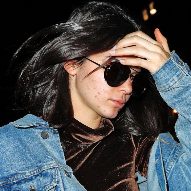 Không photoshop, siêu mẫu quốc tế như Kendall Jenner cũng lộ làn da nổi mụn sần sùi kém sắc! - Ảnh 9.