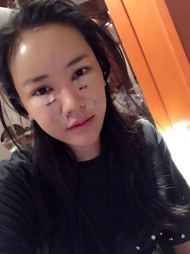 Maya tự tin khoe ảnh khuôn mặt vừa phẫu thuật thẩm mỹ tại Hàn Quốc - Ảnh 1.