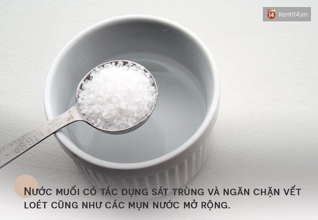 Thời tiết thất thường, đừng để cơ thể mắc căn bệnh “xấu không thể giấu” này - Ảnh 2.