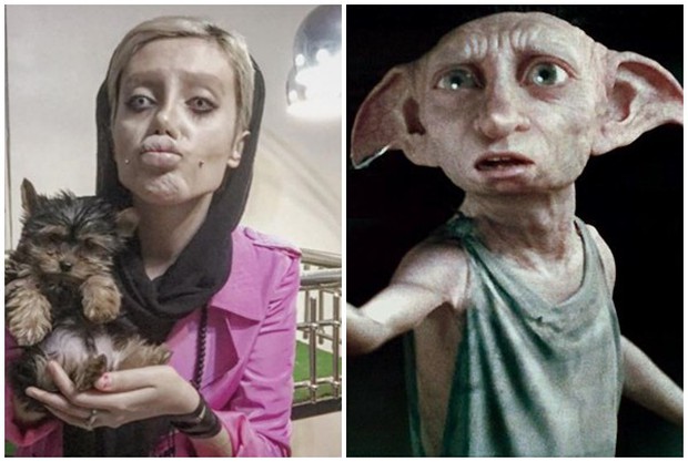 Girl had plastic surgery more than 50 times to look like Angelina Jolie, the result returned to Dobby the house elf - Photo 6.