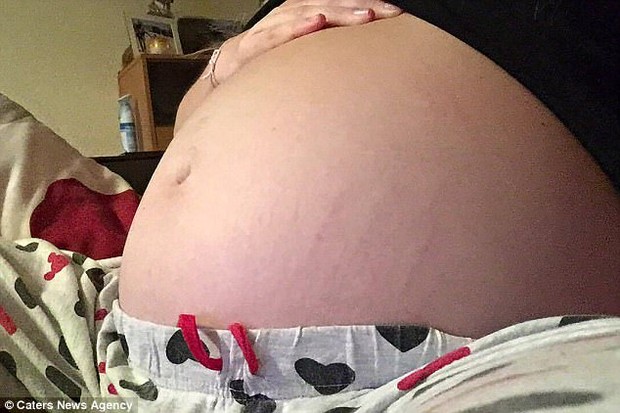 Tưởng mang bầu 8 tháng, bà mẹ giật mình phát hiện thứ kinh dị này trong bụng - Ảnh 2.