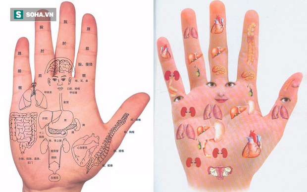 Một điểm trên bàn tay bị đỏ: Dấu hiệu cảnh báo bệnh gan không thể xem nhẹ - Ảnh 2.