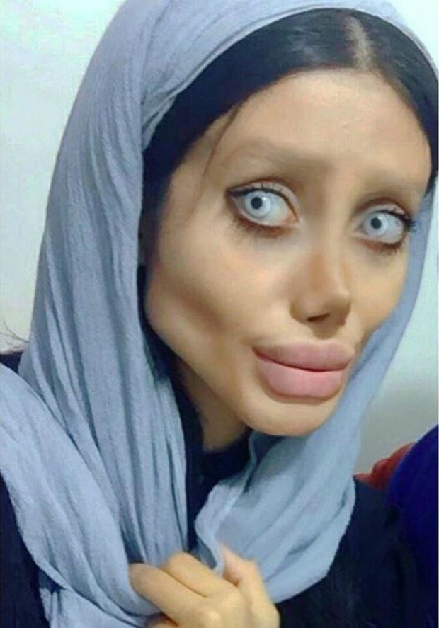 Before plastic surgery 50 times, the girl with the same face as Angelina Jolie used to be this beautiful - Photo 2.