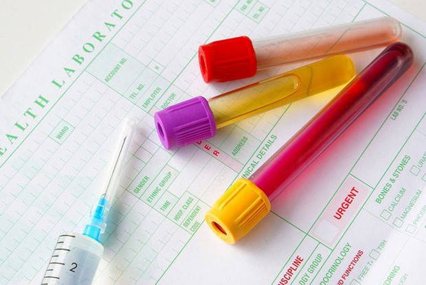 Đi tiểu ra máu là dấu hiệu của nhiều bệnh nghiêm trọng: Hãy chớ coi thường! - Ảnh 2.