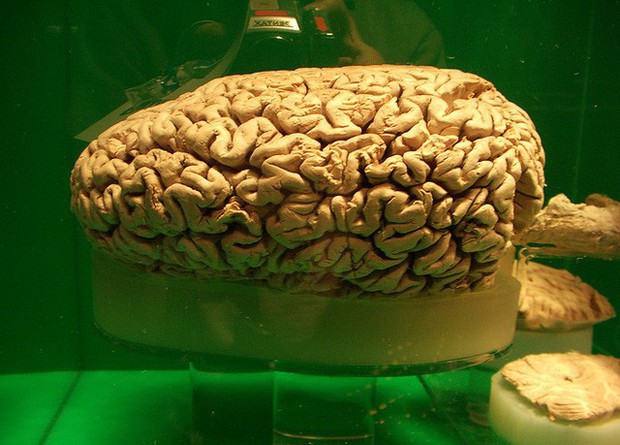 6 quan niệm sai lầm về bộ não có thể bạn không biết - Ảnh 1.