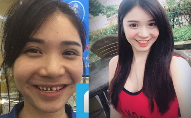 Nếu tháo hết răng sứ, liệu có ai dám nhìn Nguyễn Thị Thành khi cười? - Ảnh 5.