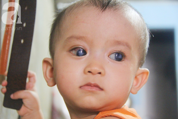 Điều kỳ diệu đến với Gia Anh, bé trai 14 tháng tuổi có đôi mắt màu xanh đi tìm ánh sáng - Ảnh 6.